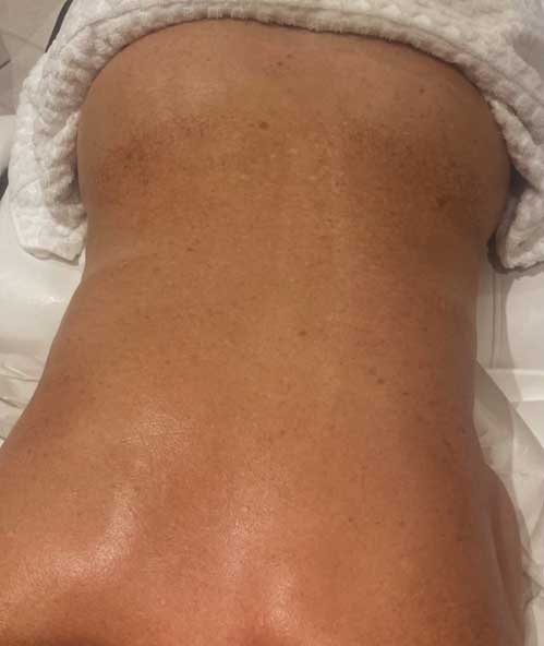 Body Contour Before